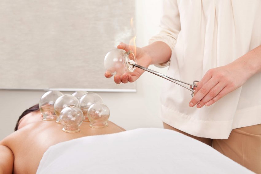 Cupping - P1000