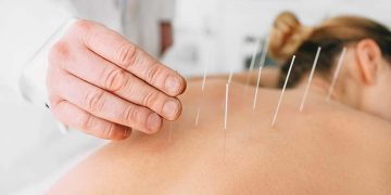 TCM‘s Pain Management